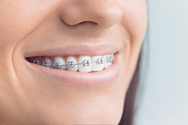 Best Wisdom Tooth Removal  in Salida, CA